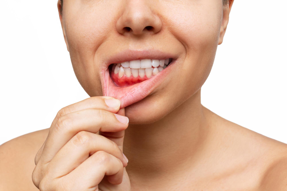 Gum Disease Treatment in Ahmedabad