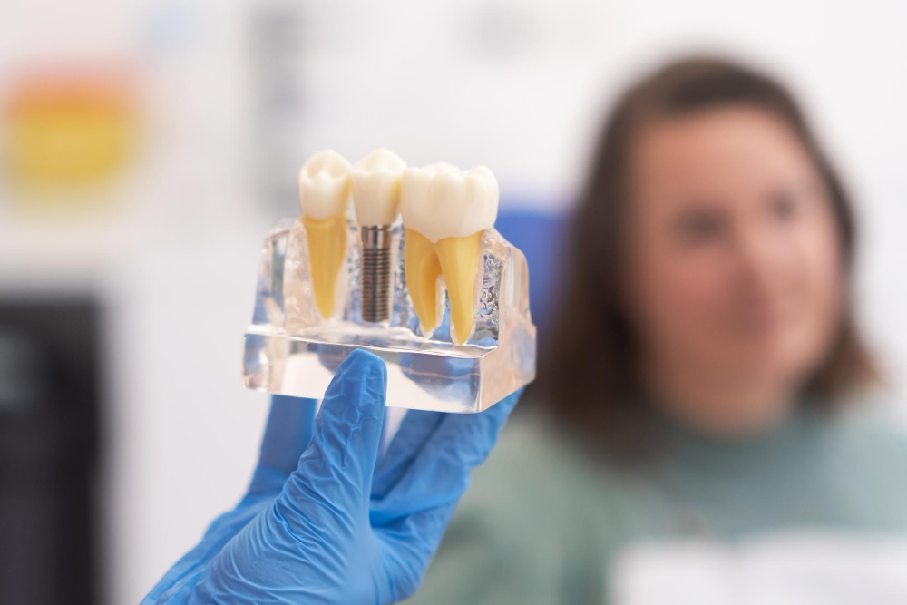 dental implants in Ahmedabad